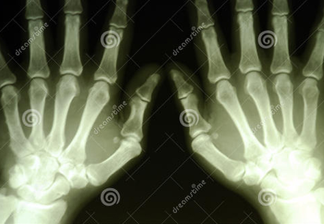 天美mv星空mv免费观看揭（jiē）秘：安檢機的X射（shè）線